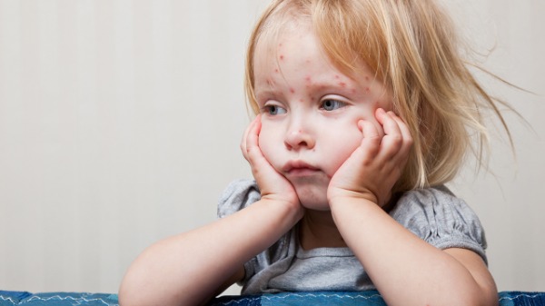 孩子手腳脫皮是為什么？如何防止冬天手腳脫皮？