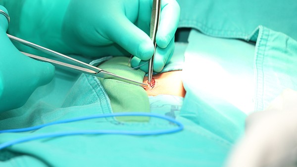 腋下狐臭手術腋下痛