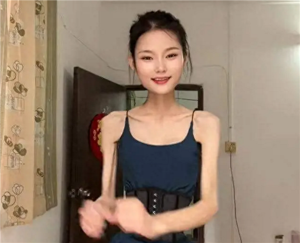 畫面太美！女子身高1米6體重50斤仍減肥 網友質疑真實性：本人回應