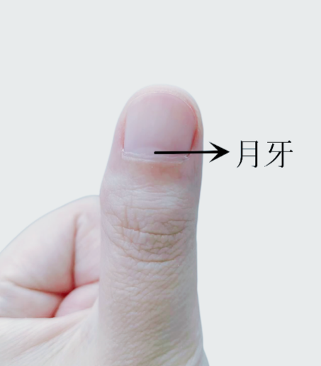 指甲出現一條黑線 別不當回事！可能是癌變