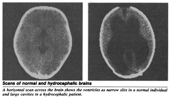 法國一公務(wù)員腦子里都是水:竟然還能正常生活!