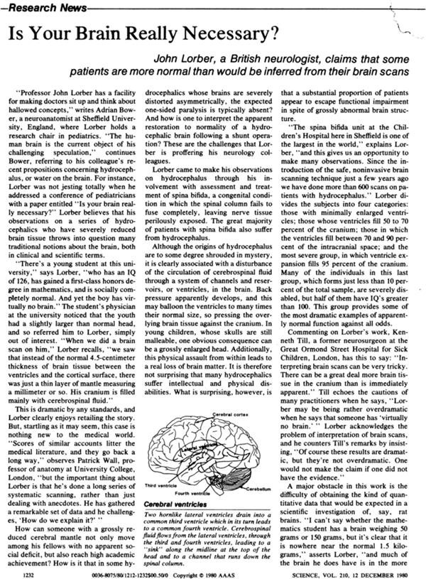 法國一公務(wù)員腦子里都是水:竟然還能正常生活!