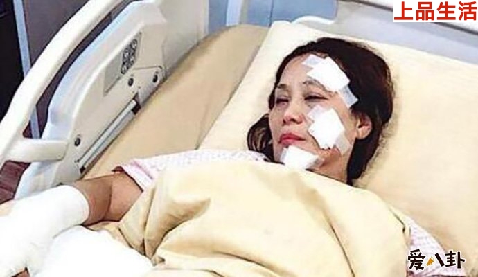 楊盼盼片場燒傷怎么回事