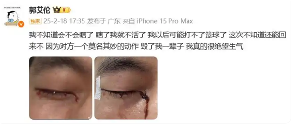 陶勇醫生談郭艾倫眼睛縫40多針：可以恢復的很好 不會影響運動生涯